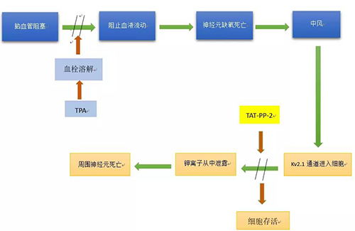 腦卒中形成機(jī)制
