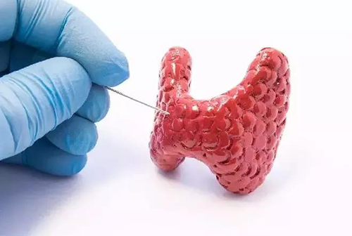 甲狀腺疾病，包括甲狀腺功能減退和甲狀腺功能亢進(jìn)，自古以來(lái)就是反復(fù)被醫(yī)學(xué)研究人員研究的疾病